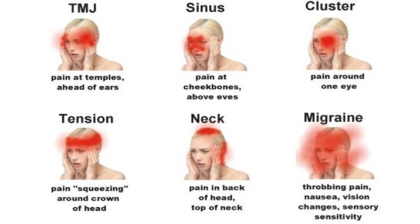 Cara Mengetahui Jenis Sakit Kepala yang Berbahaya