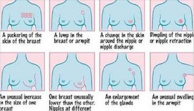 Tanda - tanda kanker payudara