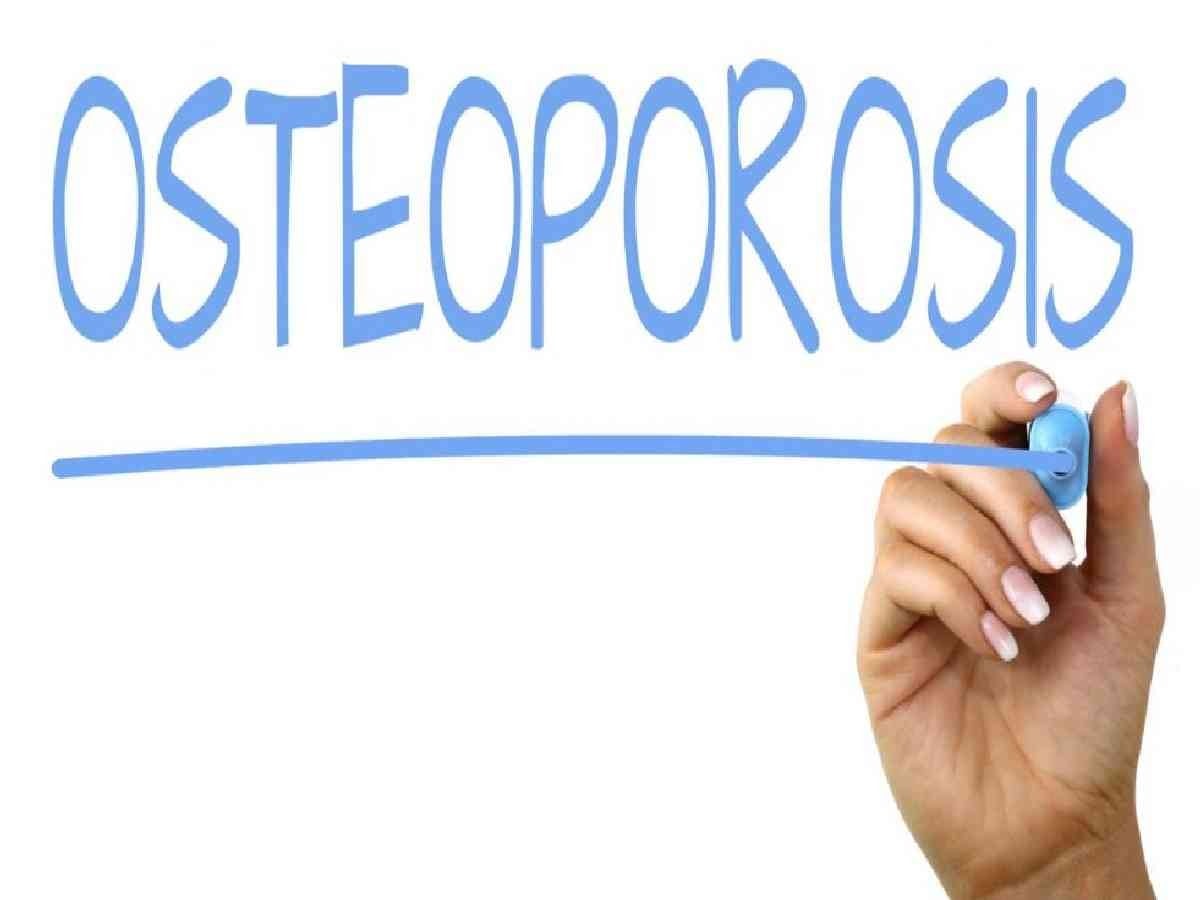 Penyakit Osteoporosis
