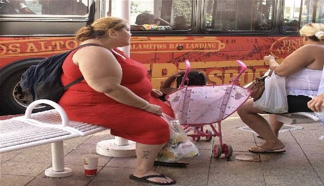 Wanita obesitas
