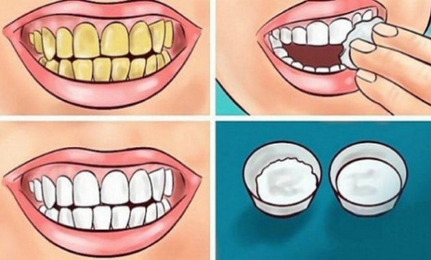 Cara memutihkan gigi kuning dalam 3 menit